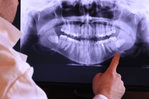 Best Emergency Denture Repair in Los Molinos, CA