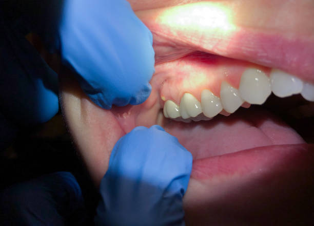 Best Pediatric Emergency Dentist in Los Molinos, CA