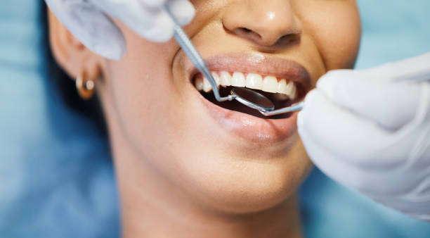 Best Emergency Dental Care for Broken or Chipped Teeth in Los Molinos, CA