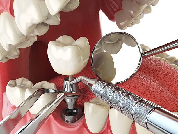 Best Weekend Emergency Dentist in Los Molinos, CA
